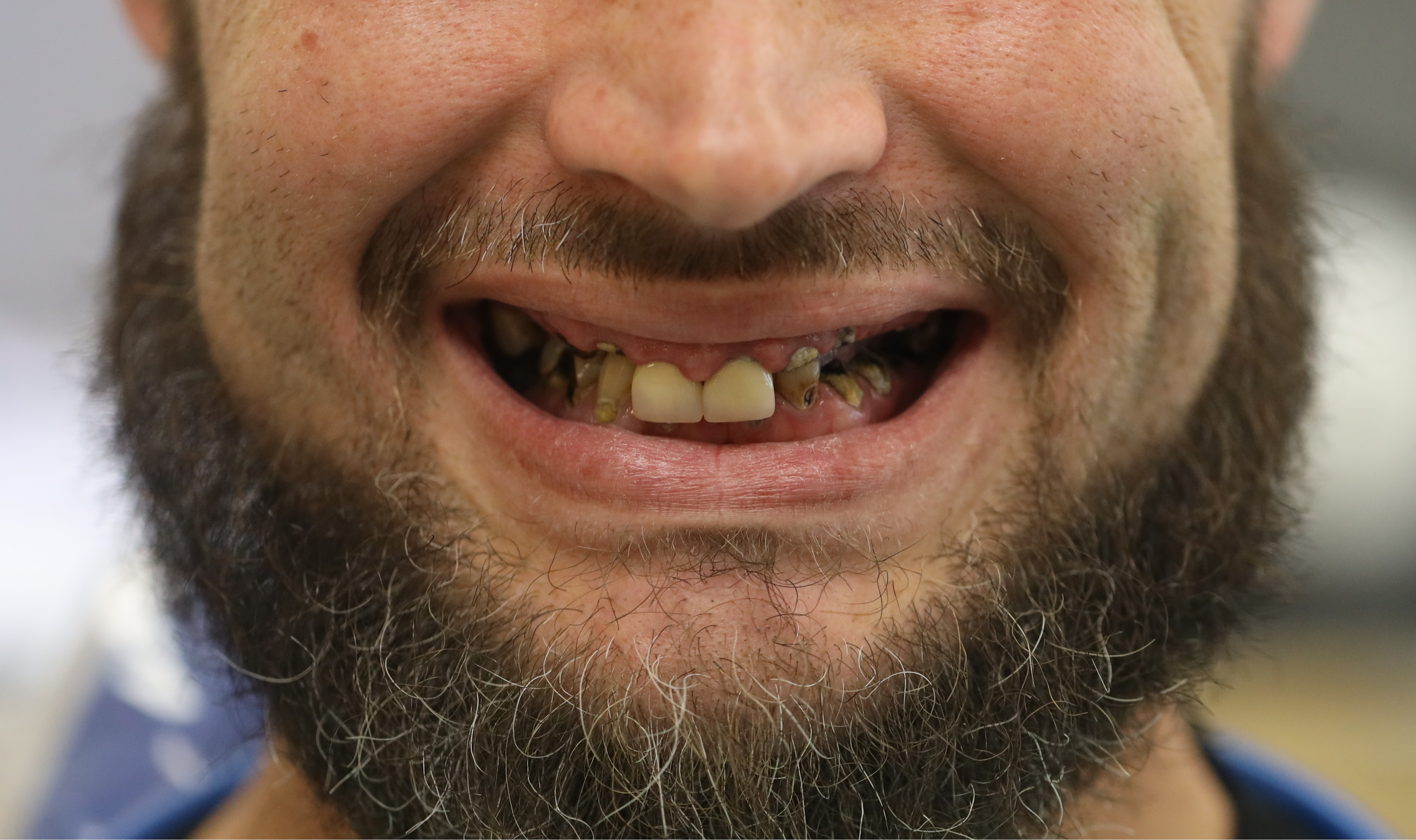 New Hope Digital Dentures